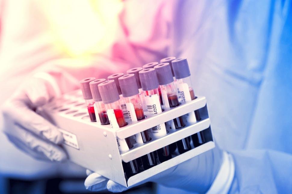blood-samples--blood-tests--medical-tests